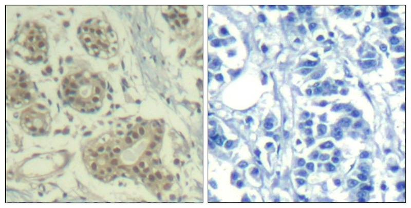 Anti-Phospho-MDM2 (Ser166) Polyclonal Antibody