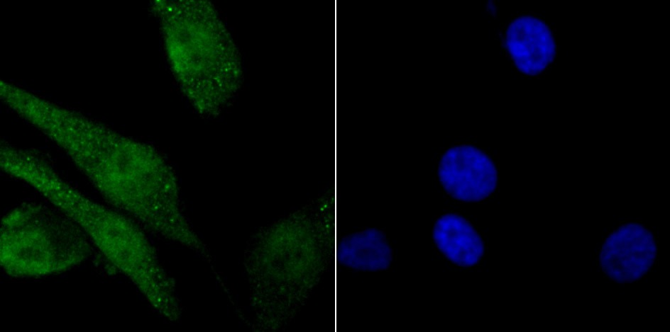 Anti-macroH2A.1 Antibody (7A412)