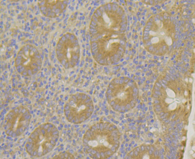 Anti-MARK2 Antibody (5N875)