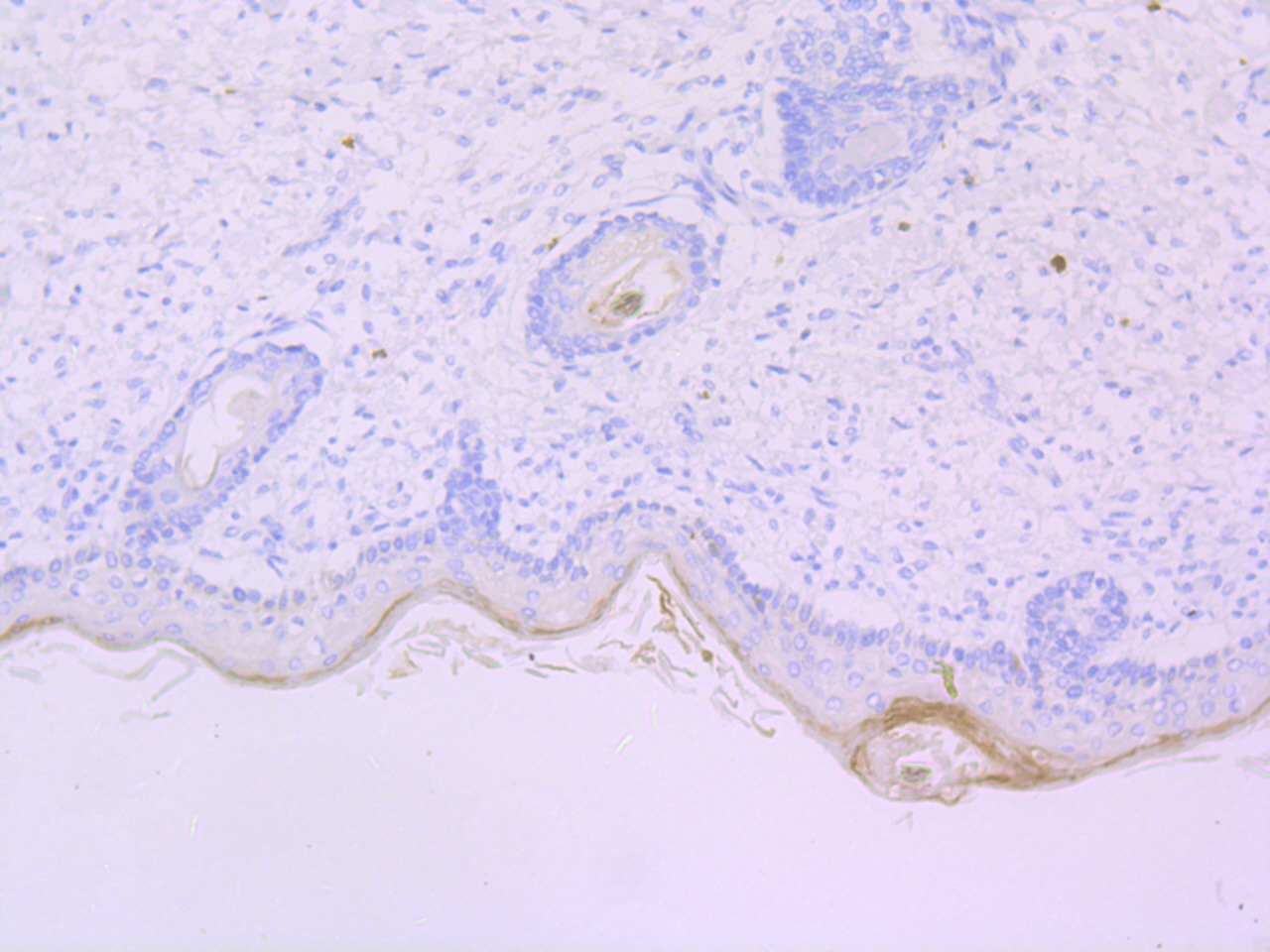 Anti-Chymase 1 Antibody (7I538)