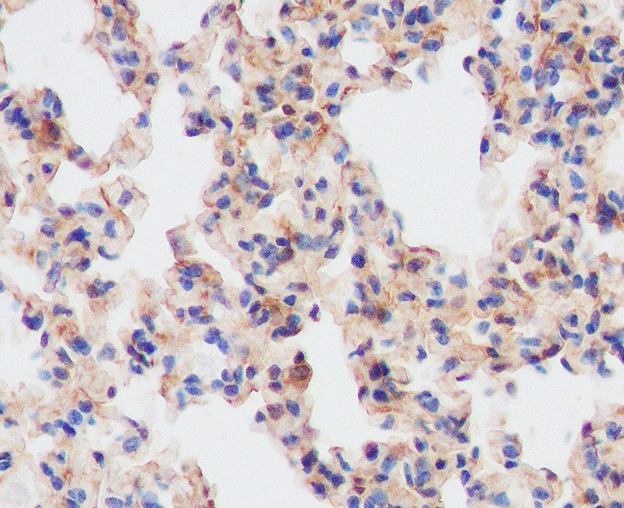 Anti-Phospho-MCU (S92) Polyclonal Antibody