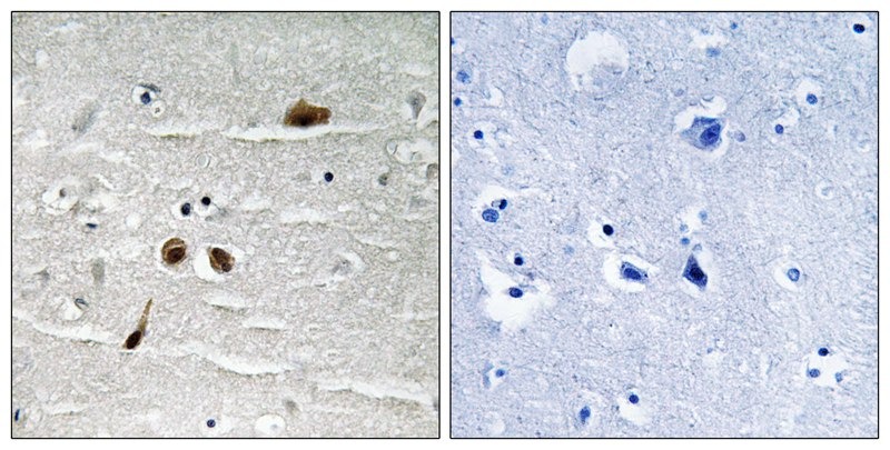 Anti-Phospho-MDC1 (Ser513) Polyclonal Antibody
