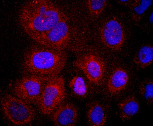 Anti-LYVE1 Antibody (3Z624)