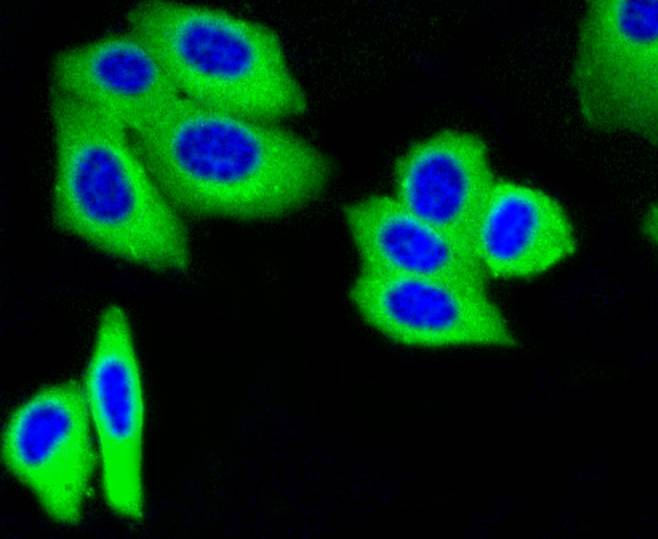 Anti-IGF2R Antibody (3T816)