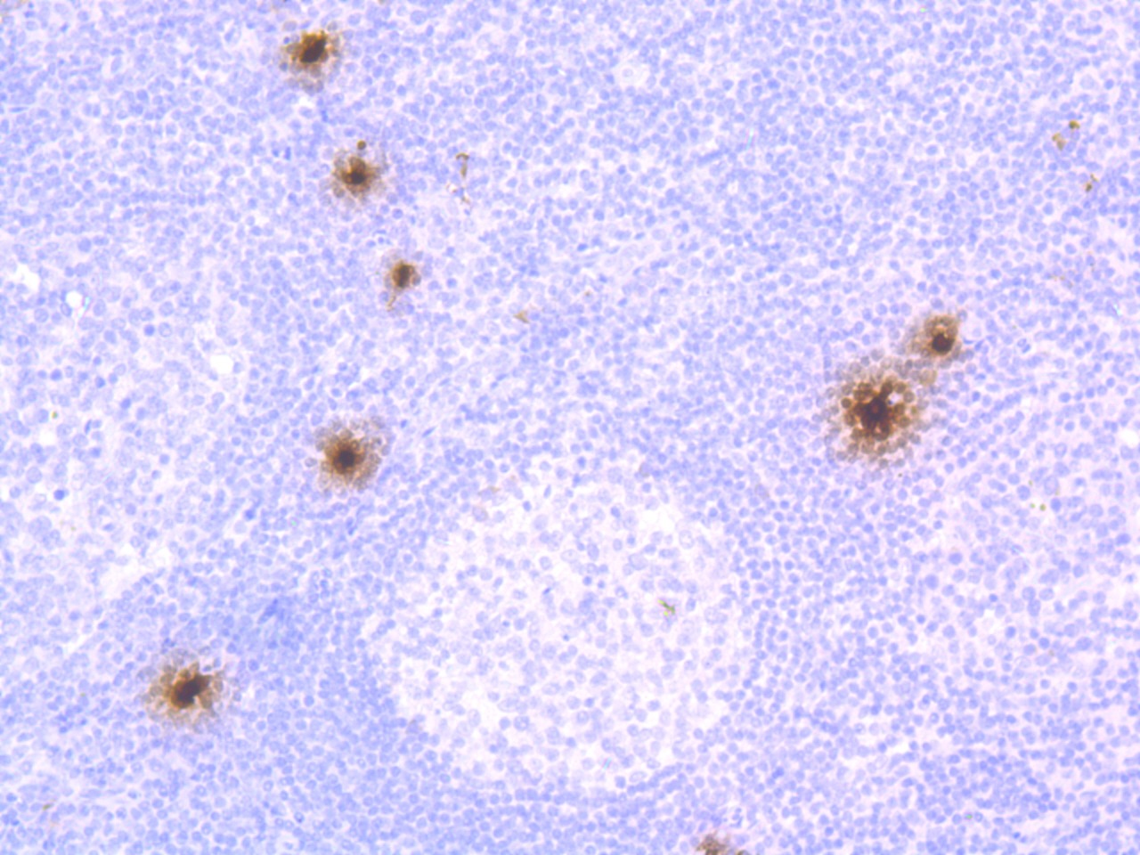 Anti-Chymase 1 Antibody (7I538)