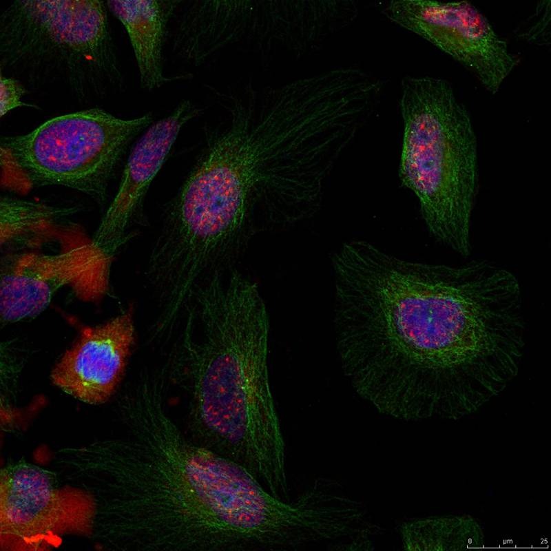 Anti-Phospho-MDM2 (Ser166) Polyclonal Antibody