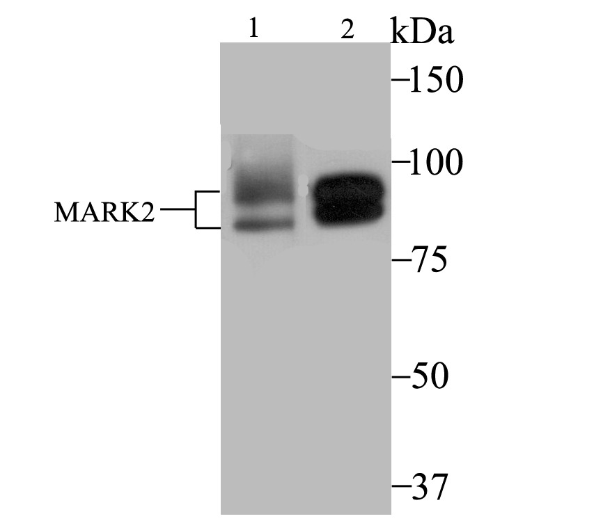 Anti-MARK2 Antibody (5N875)