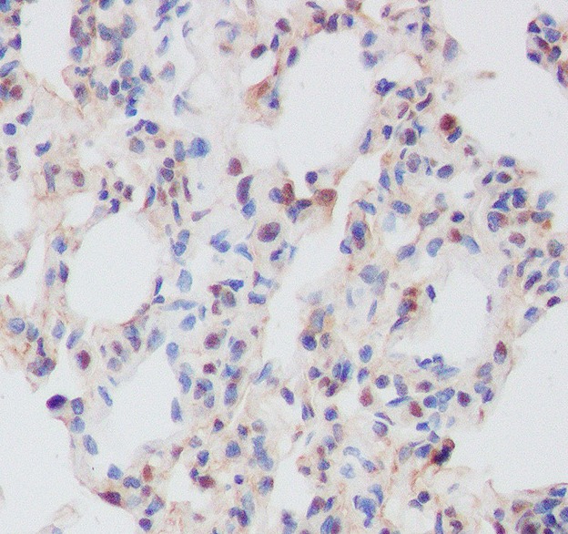 Anti-Phospho-MCU (S92) Polyclonal Antibody