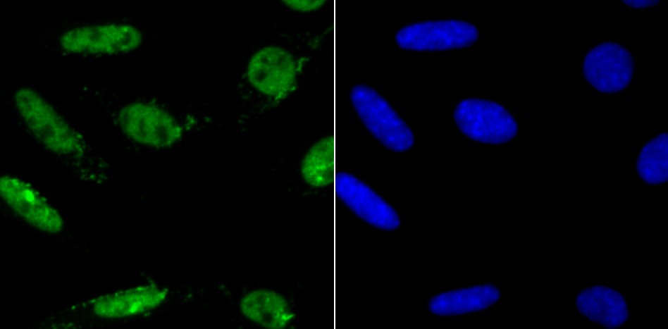 Anti-MAD2L1 Antibody (2Y202)