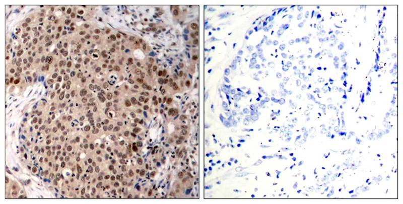 Anti-Phospho-MAPKAPK2 (Thr334) Polyclonal Antibody
