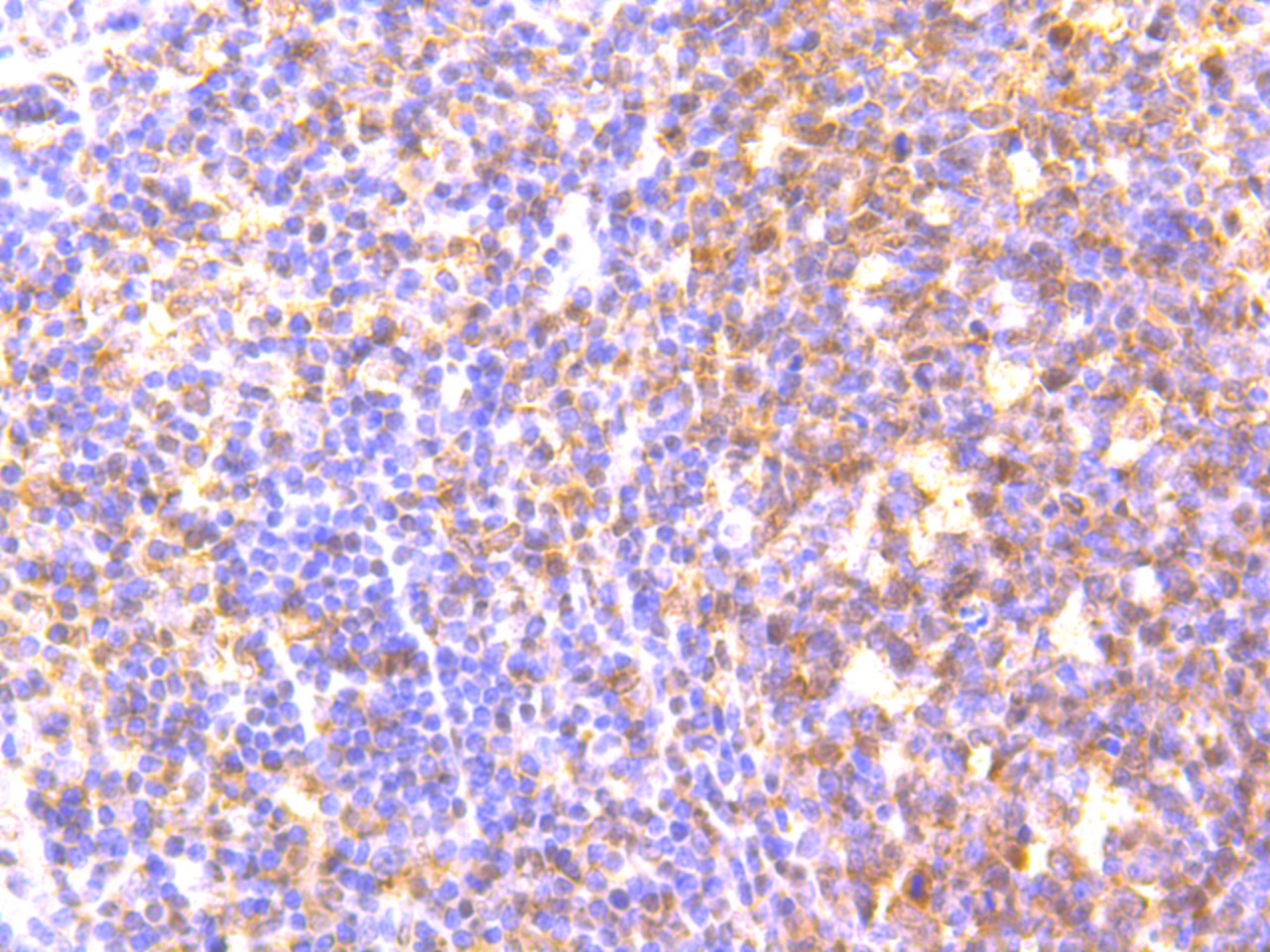 Anti-MAD2L2 Antibody (7W975)