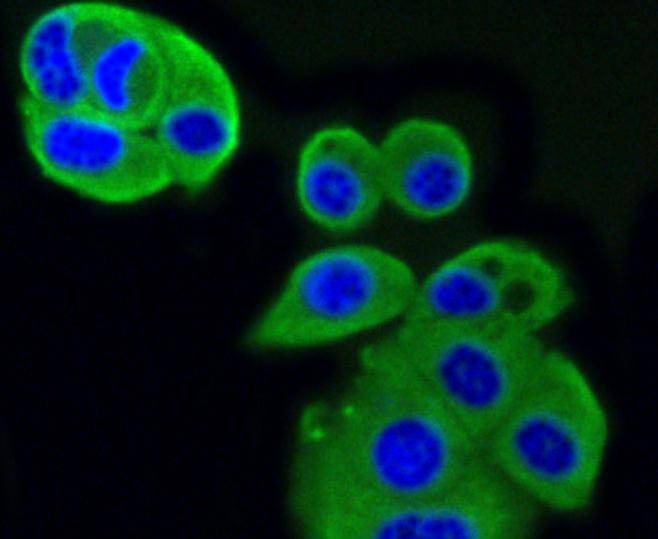 Anti-IGF2R Antibody (3T816)
