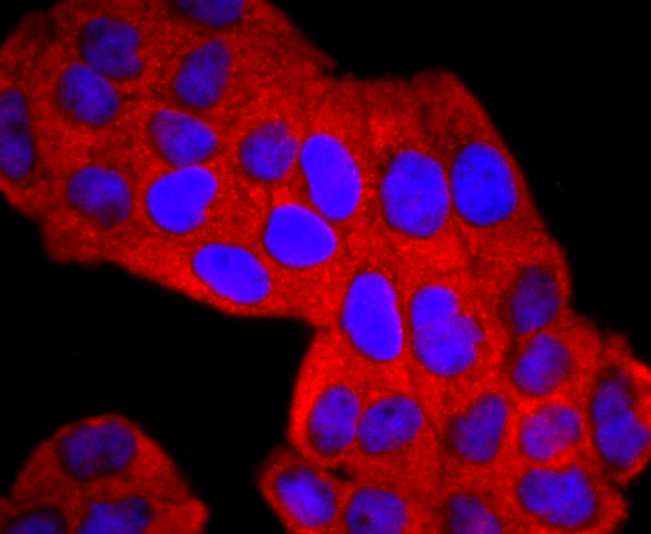 Anti-Lipocalin-2/LCN2 Antibody (7K2)