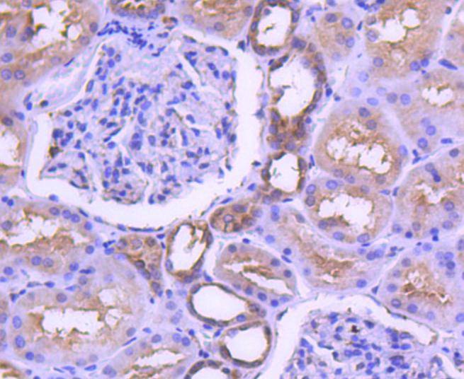 Anti-MAP2K1 Antibody (3D339)