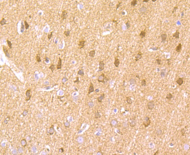 Anti-LNP Antibody (3D893)