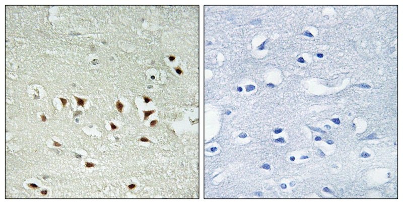 Anti-Phospho-MAPKAPK2 (Thr334) Polyclonal Antibody 3