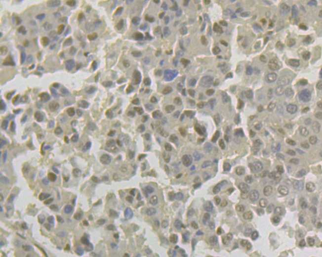 Anti-Lipin 1 Antibody (5B766)