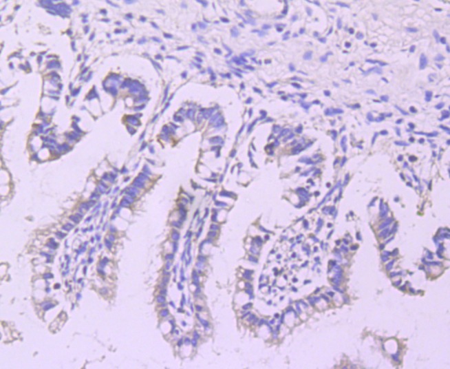 Anti-Lipoprotein lipase Antibody (3S505)