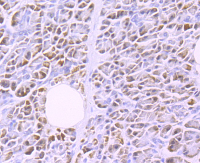 Anti-Lipoprotein lipase Antibody (3S505)