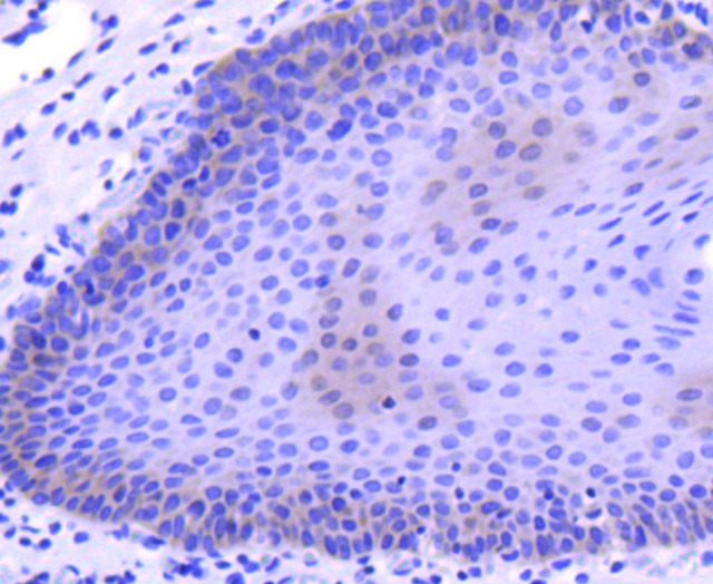 Anti-M-CSF/CSF1 Antibody (2H817)