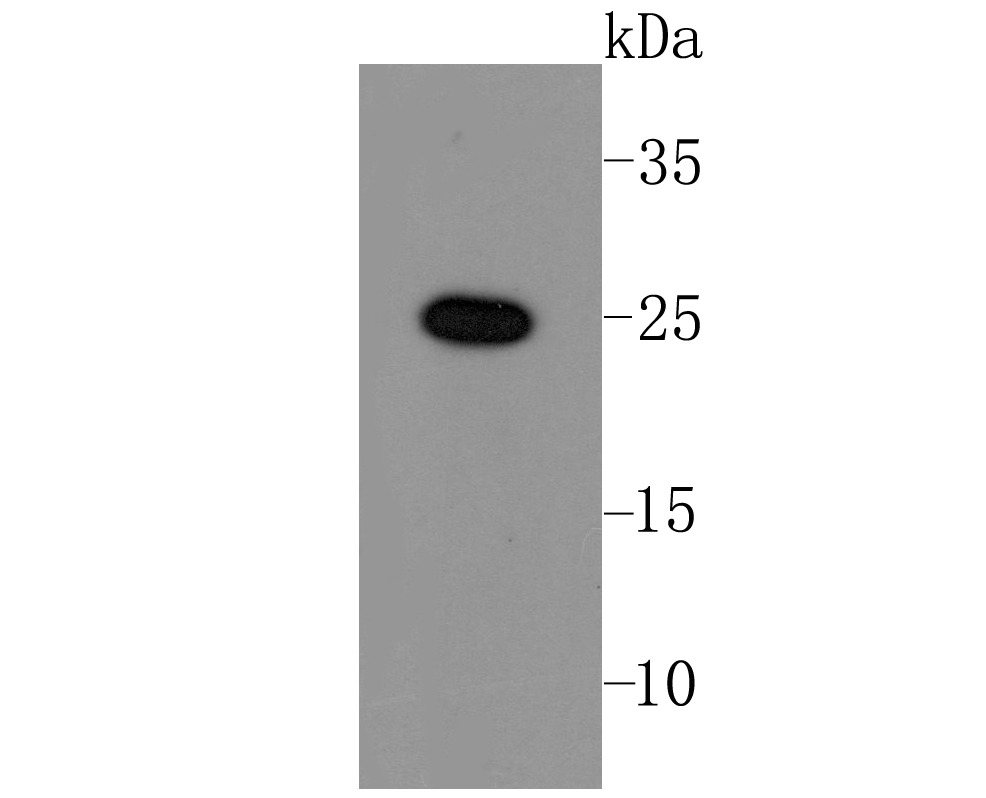 Anti-LIN28A Antibody (9B112)