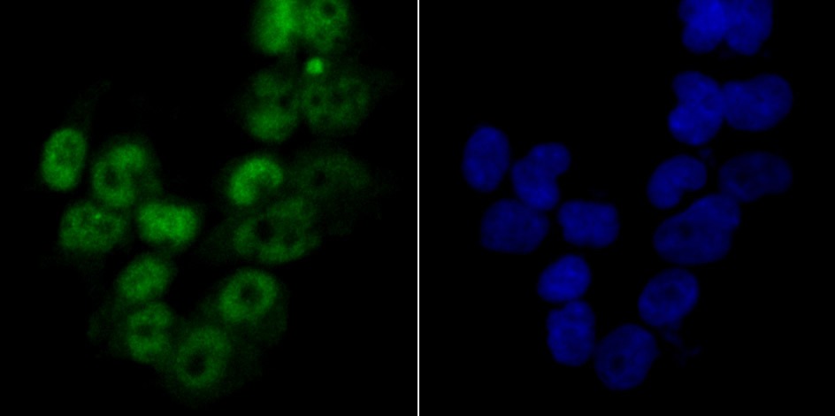 Anti-MCM3 Antibody (3T338)