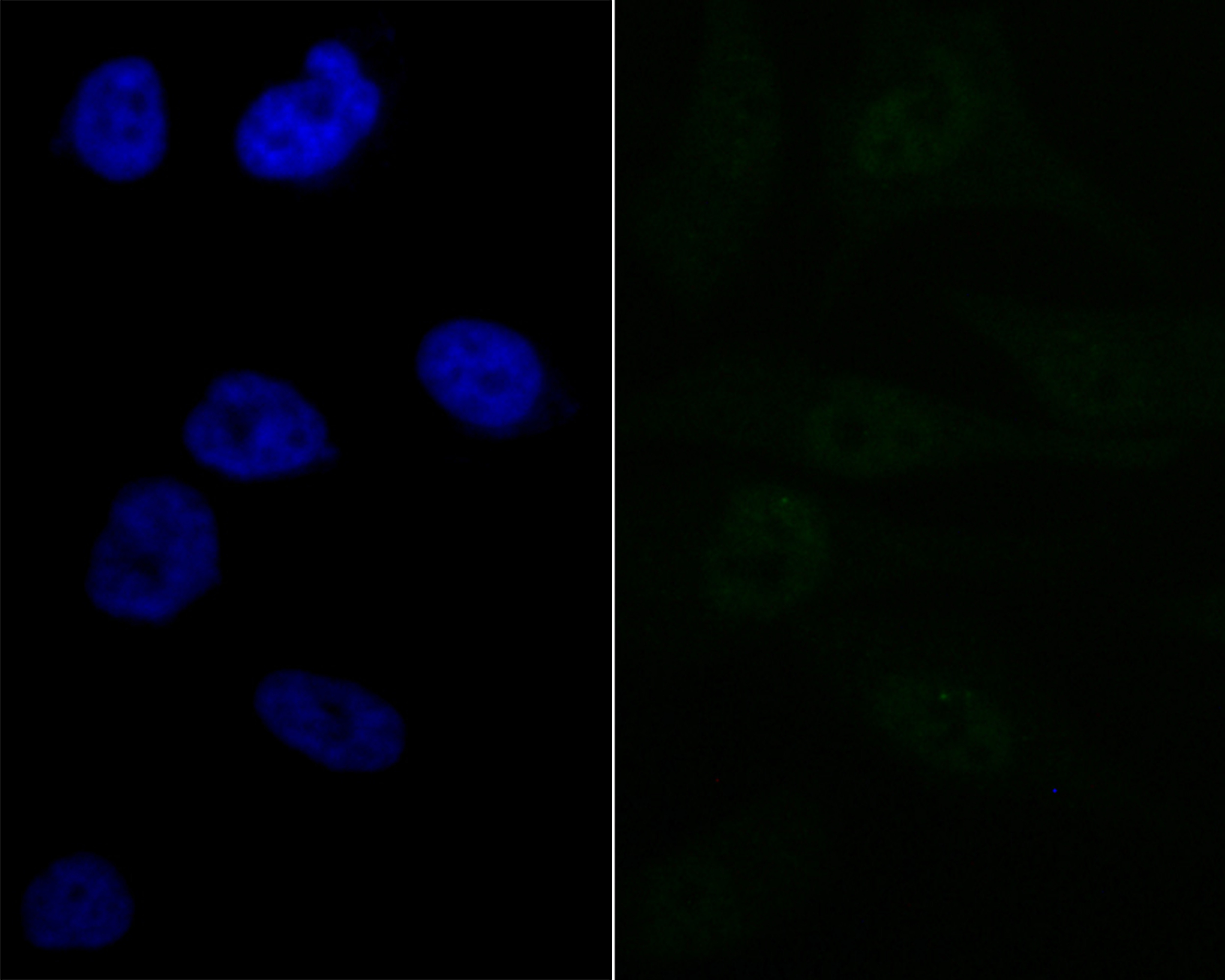 Anti-Lipin 1 Antibody (5B766)