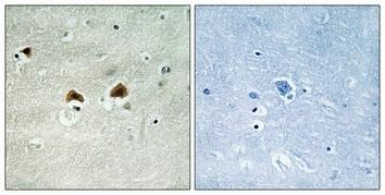 Anti-Phospho-MAP4 (Ser696) Polyclonal Antibody