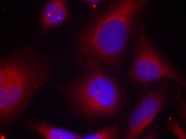 Anti-Phospho-MARCKS (Ser158) Polyclonal Antibody