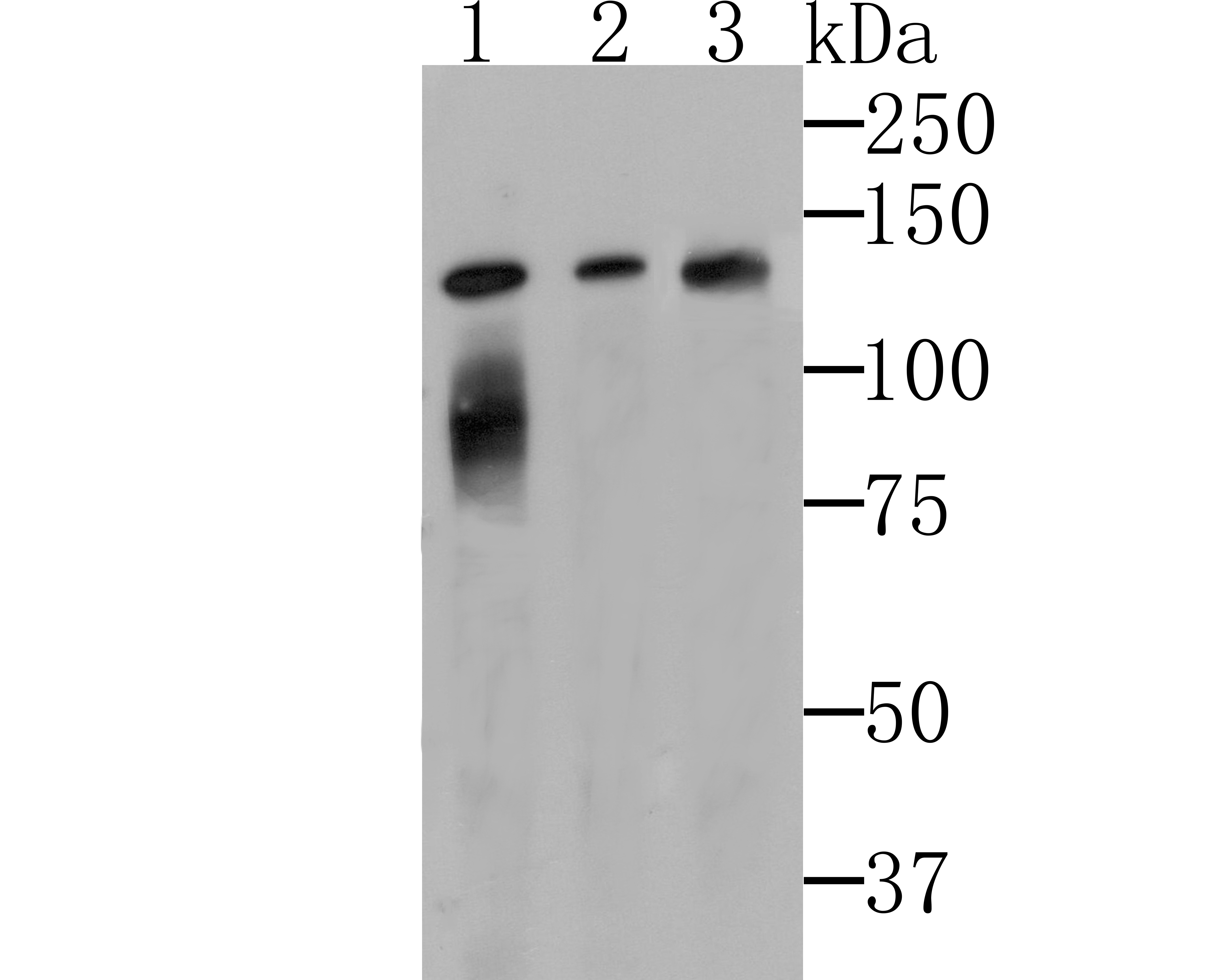 Anti-Lipin 1 Antibody (5B766)