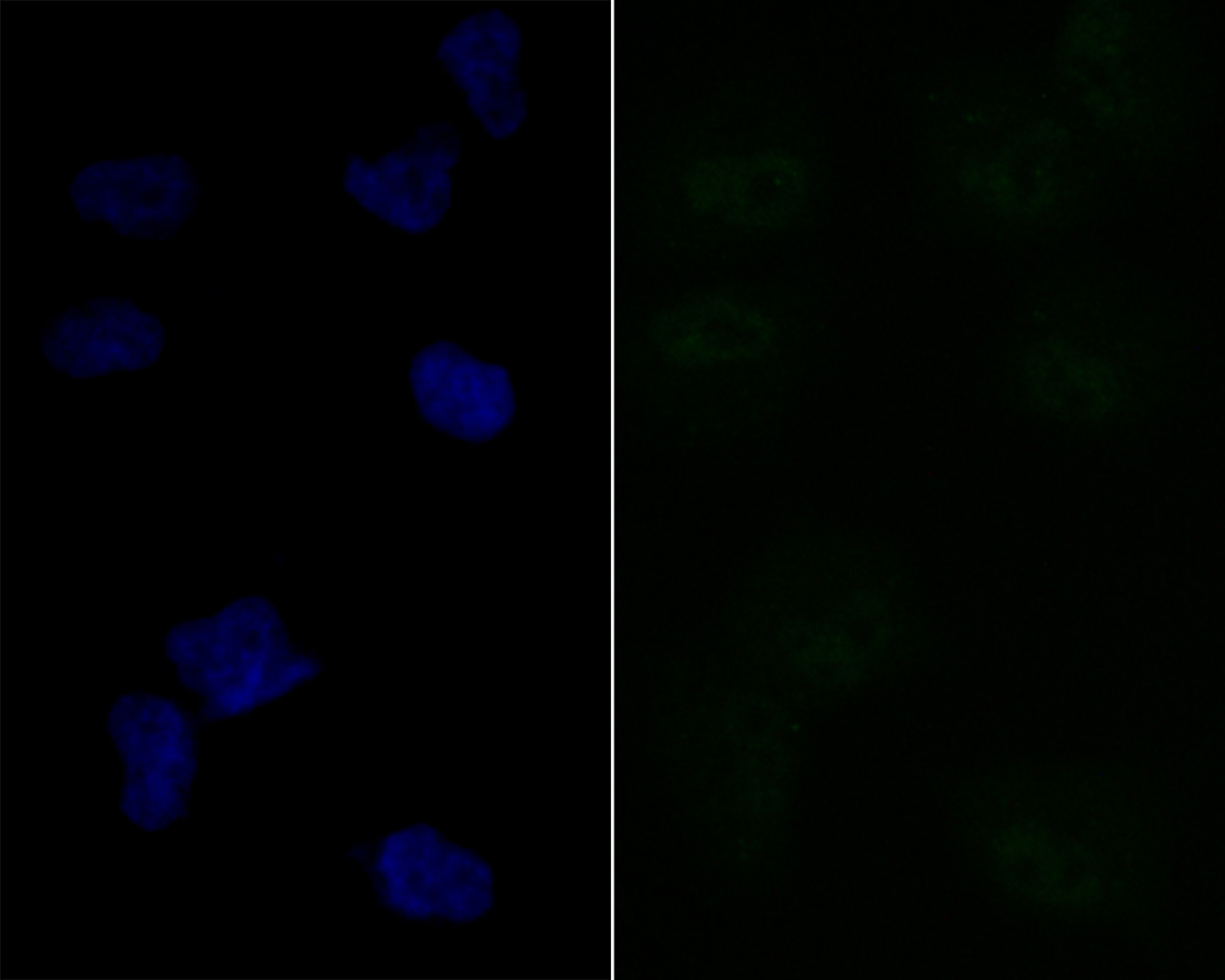 Anti-Lipin 1 Antibody (5B766)