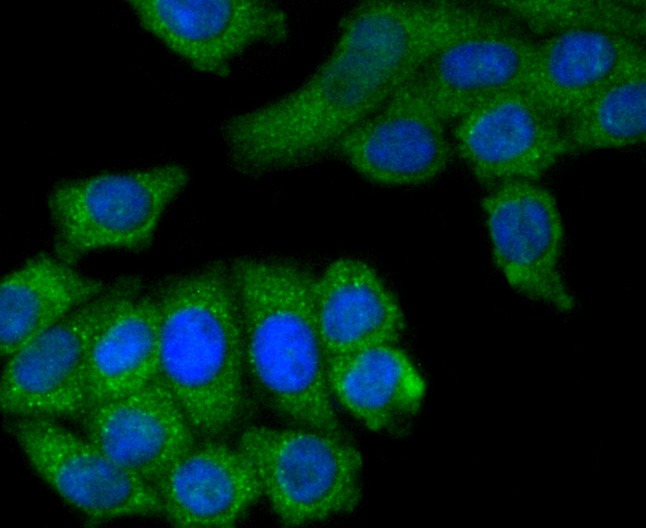 Anti-M-CSF/CSF1 Antibody (2H817)