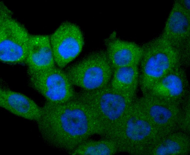 Anti-M-CSF/CSF1 Antibody (2H817)