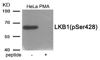 Anti-Phospho-STK11 (Ser428) Polyclonal Antibody