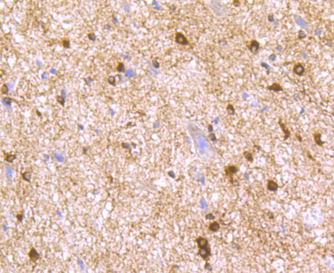 Anti-LNP Antibody (3D893)