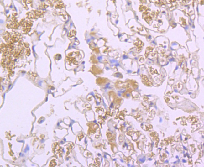 Anti-Lipocalin-2/LCN2 Antibody (7K2)