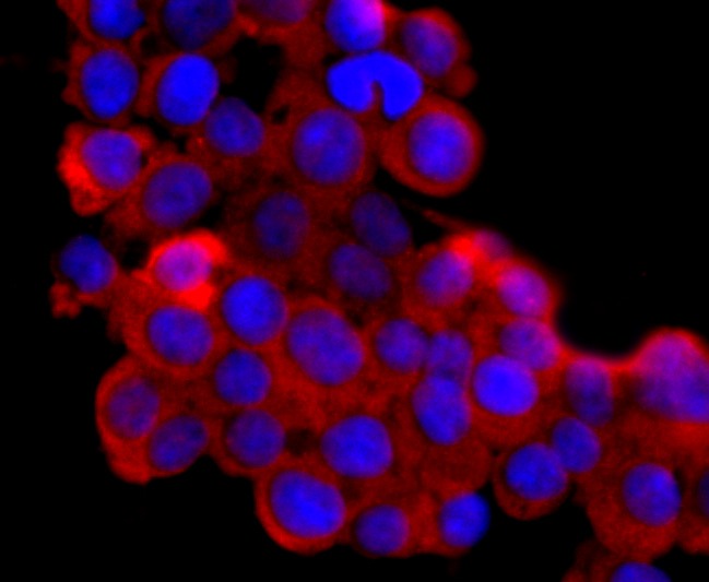 Anti-Lipocalin-2/LCN2 Antibody (7K2)