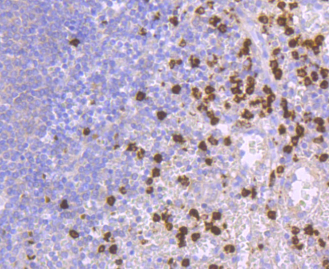 Anti-Lipocalin-2/LCN2 Antibody (7K2)