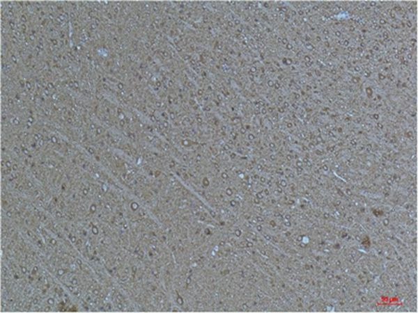 Anti-Acetyl-α-tubulin (Lys40) Antibody (4A610)