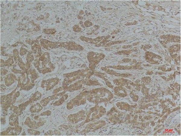 Anti-Acetyl-α-tubulin (Lys40) Antibody (4A610)