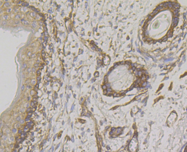 Anti-WNK1 Antibody (1S306)