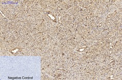 Anti-Acetyl-α-tubulin (Lys40) Antibody (6I106)