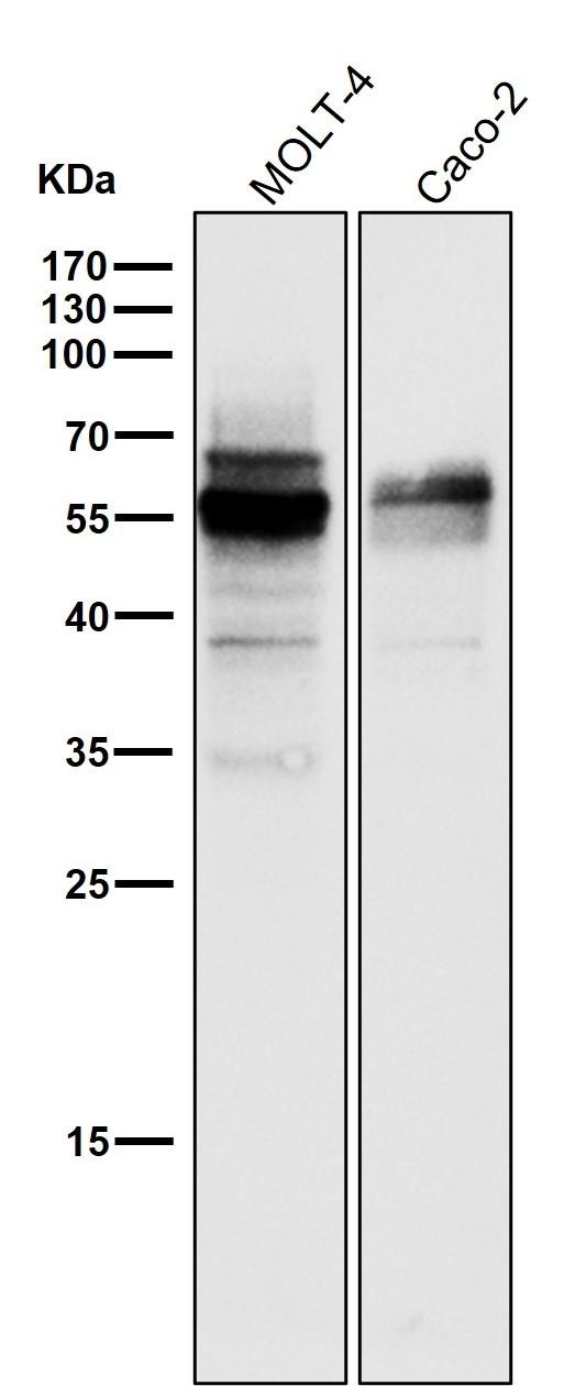 Anti-Wilms tumor/WT1 Antibody (8L145)