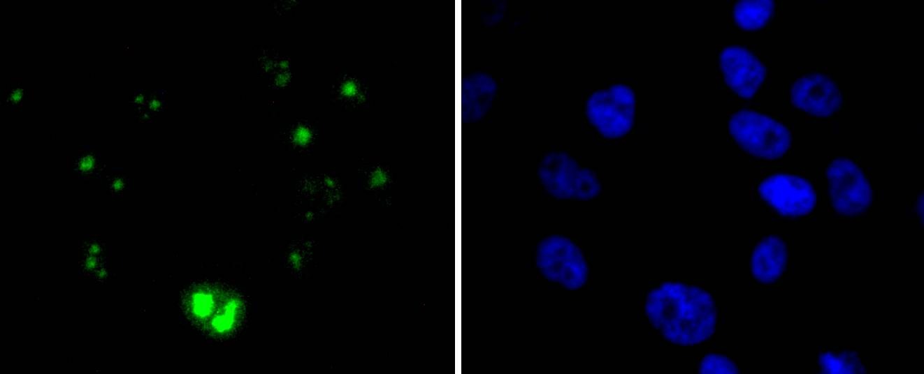 Anti-Wilms tumor/WT1 Antibody (8L145)