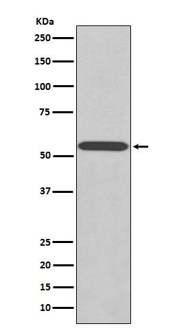 Anti-Wilms tumor/WT1 Antibody (8L145)