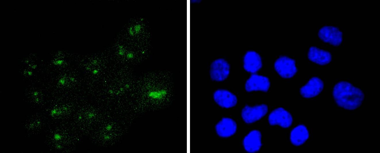 Anti-Wilms tumor/WT1 Antibody (8L145)