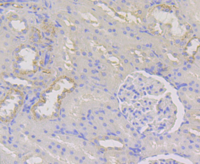 Anti-WNK1 Antibody (1S306)