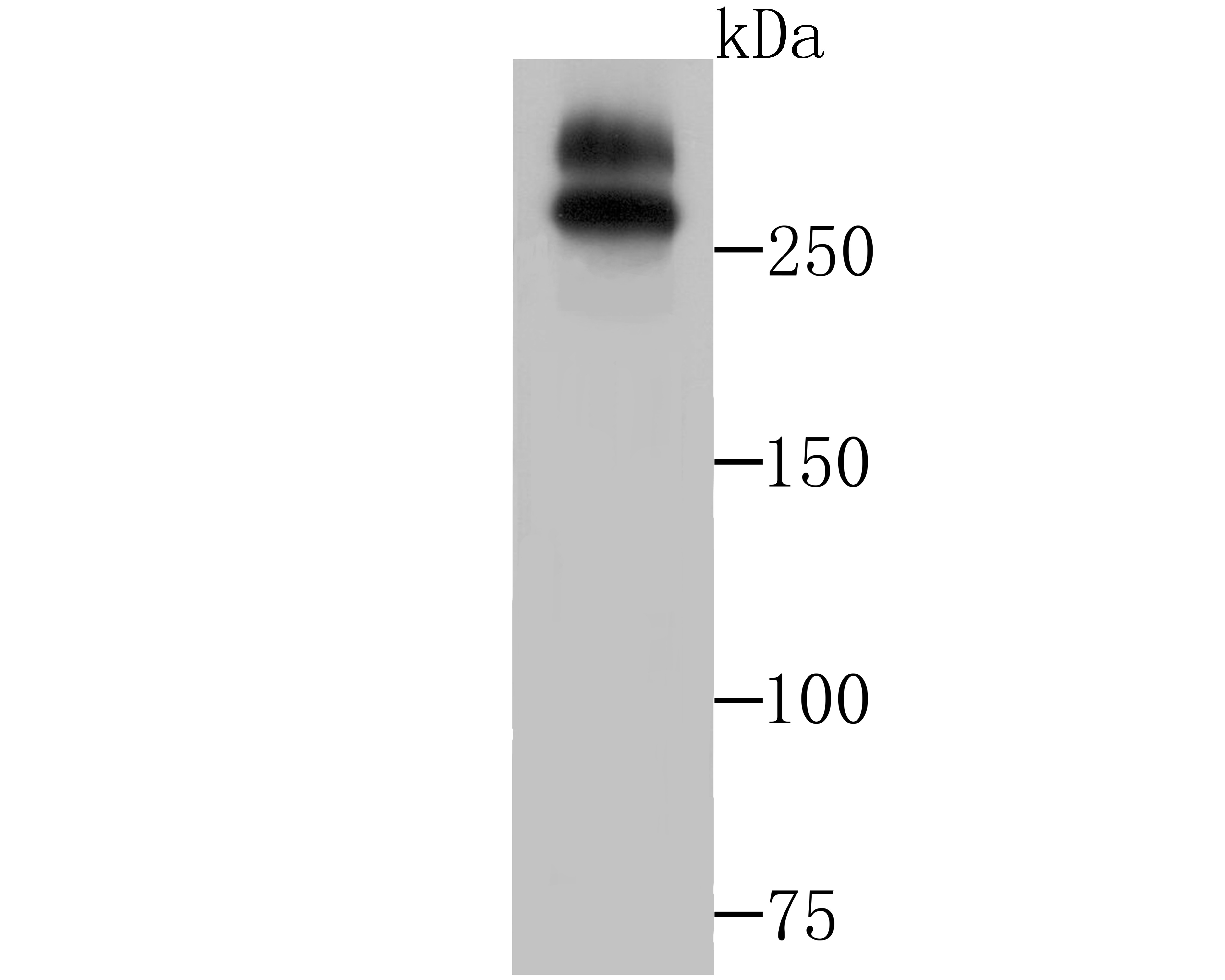 Anti-WNK1 Antibody (1S306)