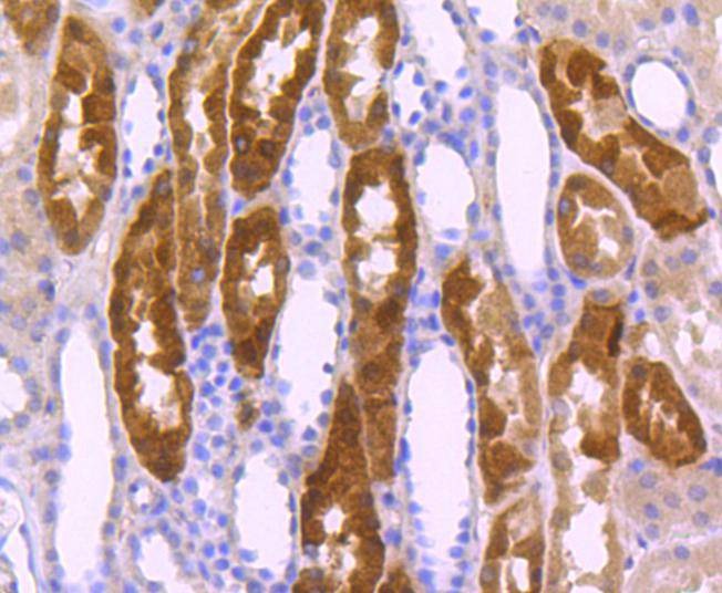 Anti-ITGA5 Antibody (5F909)