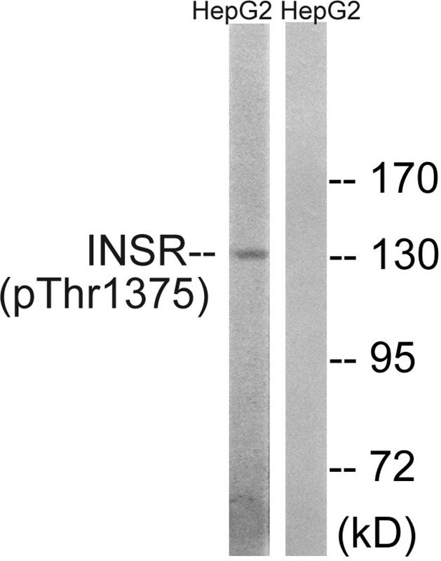 Anti-Phospho-Insulin Receptor (Thr1375) Polyclonal Antibody
